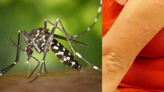 Despídete de los mosquitos con estos eficaces repelentes caseros