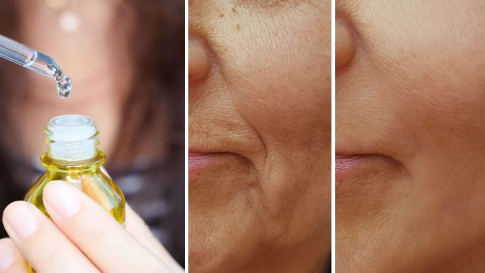 Cómo preparar un sérum facial para rejuvenecer la piel