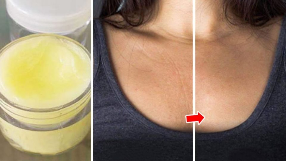 Arrugas en el pecho: la crema casera para eliminarlas rápidamente