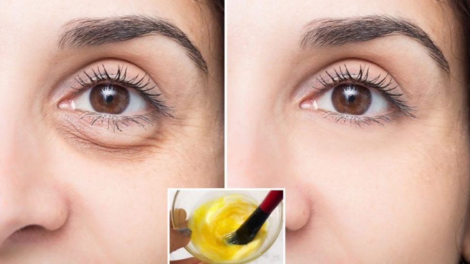 Elimina las ojeras y rejuvenece el contorno de ojos sin maquillar: 3 trucos infalibles