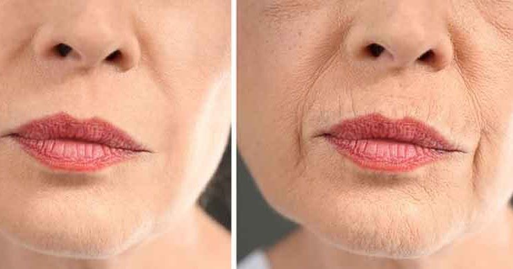 5 formas naturales de minimizar las arrugas alrededor de la boca