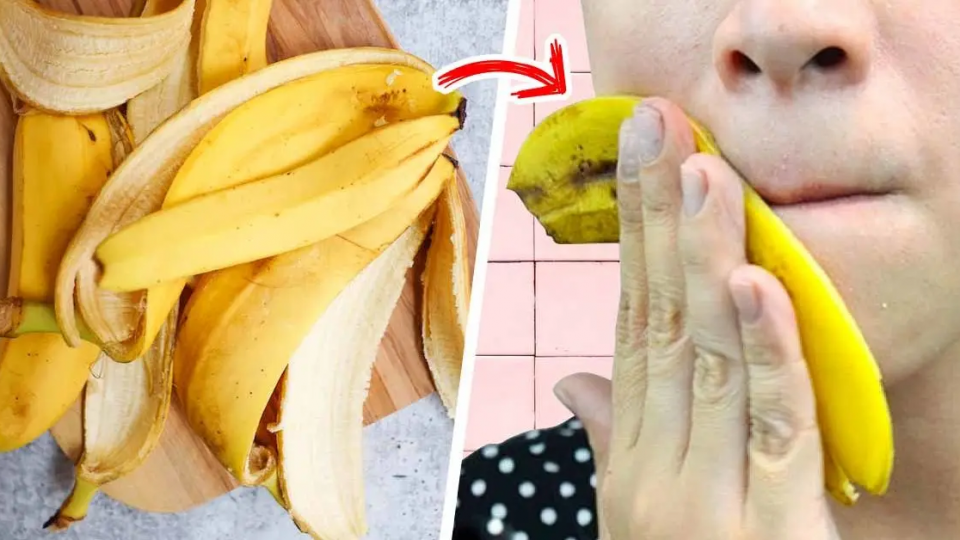 Frotar cáscara de plátano en la cara resuelve uno de los mayores problemas de la piel