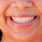 Cuidados Naturales para tus Dientes — Y Qué Evitar